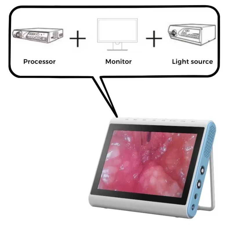 3‑In‑1 Medical Endoscopy Image - Medical Lab Images recension och pris