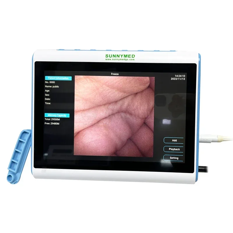 3‑In‑1 Medical Endoscopy Image - Medical Lab Images recension och pris