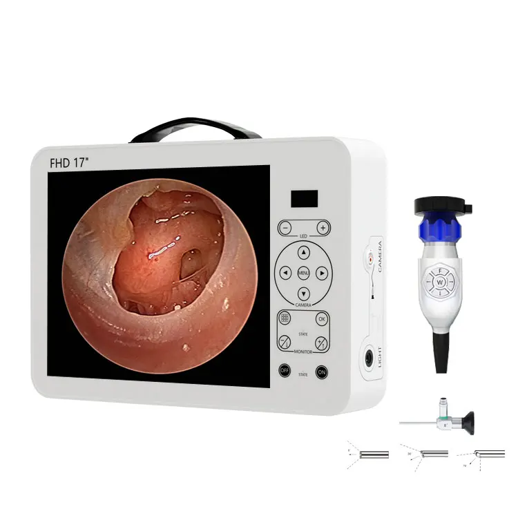 17 Inch HD Video Otoscope ENT  - Medical Lab Images recension och pris