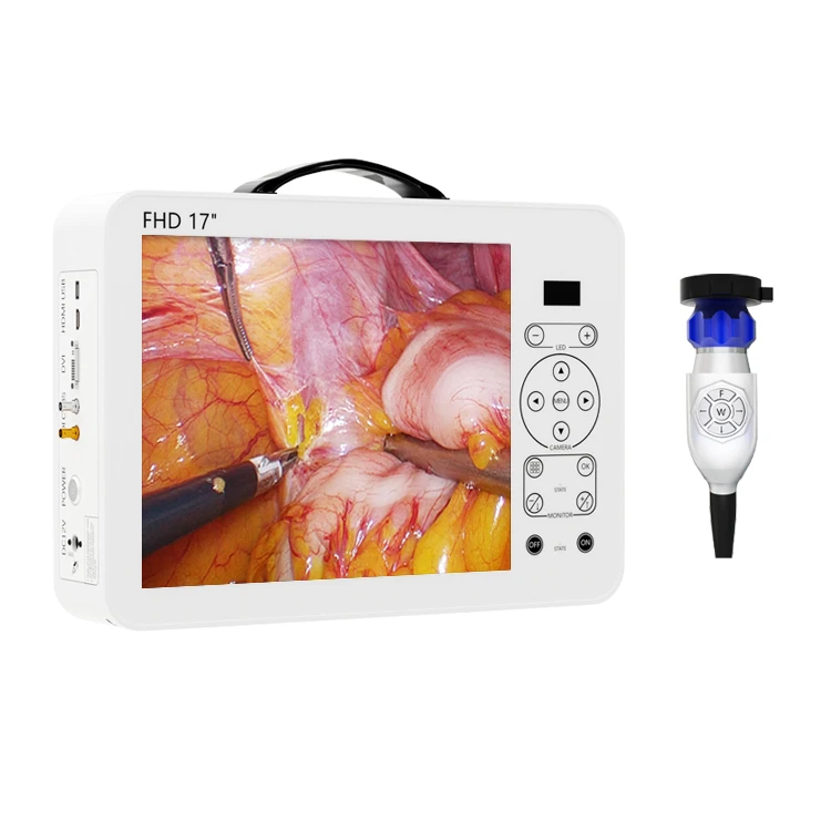 17 Inch HD Video Otoscope ENT  - Medical Lab Images recension och pris
